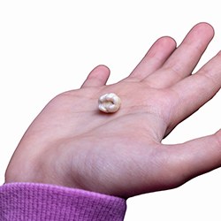 Extracted tooth resting in child’s hand
