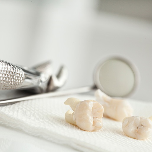 3 extracted teeth on a paper towel next to dental instruments